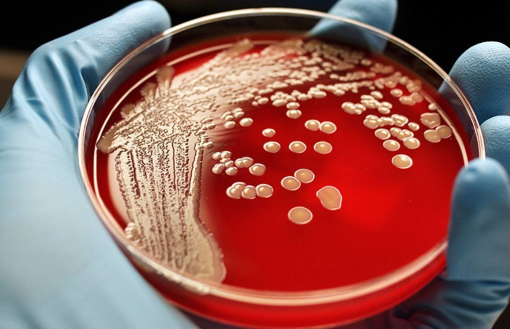 WHO confirms ‘Super Gonorrhea’ is spreading fast due to COVID-19
