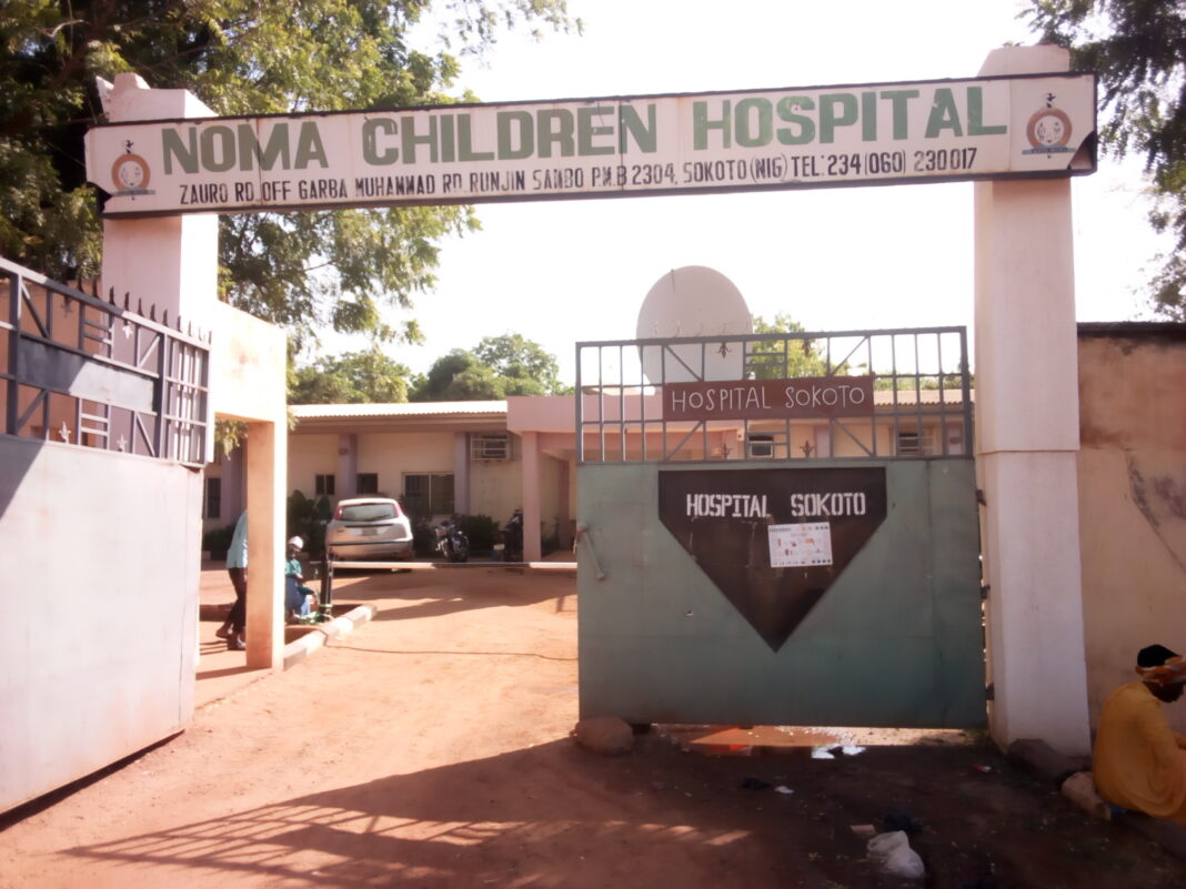Noma Children Hospital Performs 100 Eye Cataract Operations 2020 Last Quarter