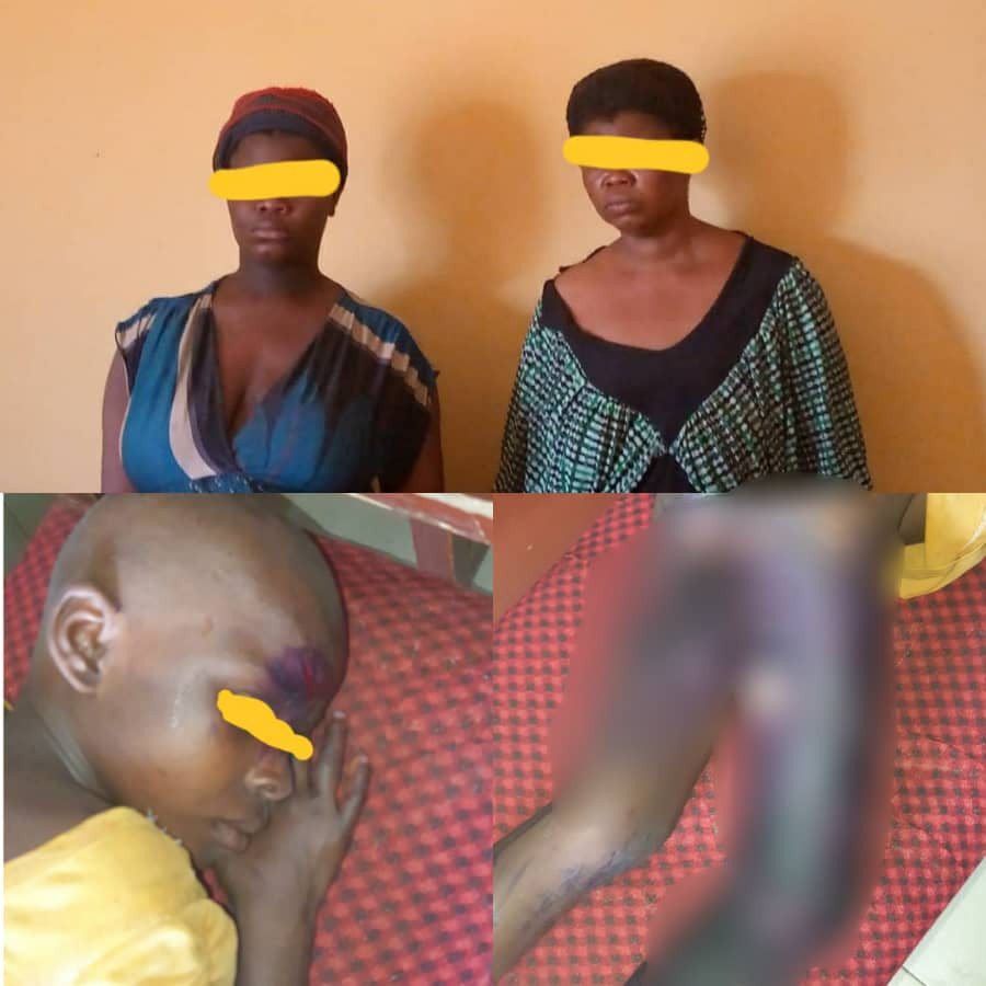 2 Women Arrested For Pouring Hot Water On 10-year-old Maid In Anambra with (pics)