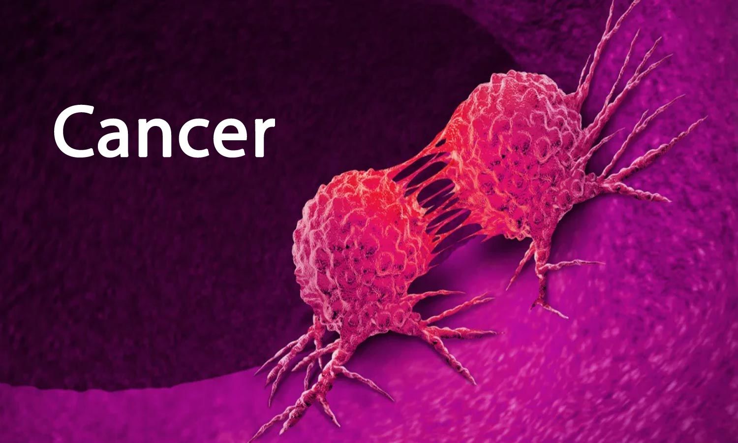 African region records 846,000 Cancer cases-  WHO