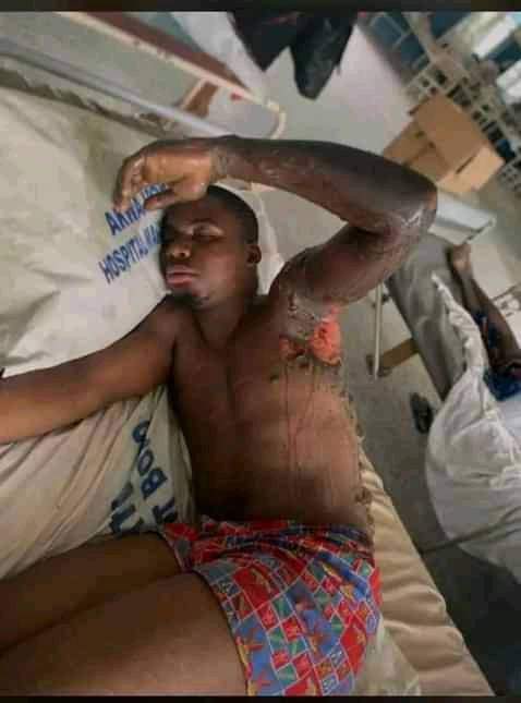 Black market petrol retailer sets undergraduate ablaze in A’Ibom Black market petrol retailer sets undergraduate ablaze in A’Ibom