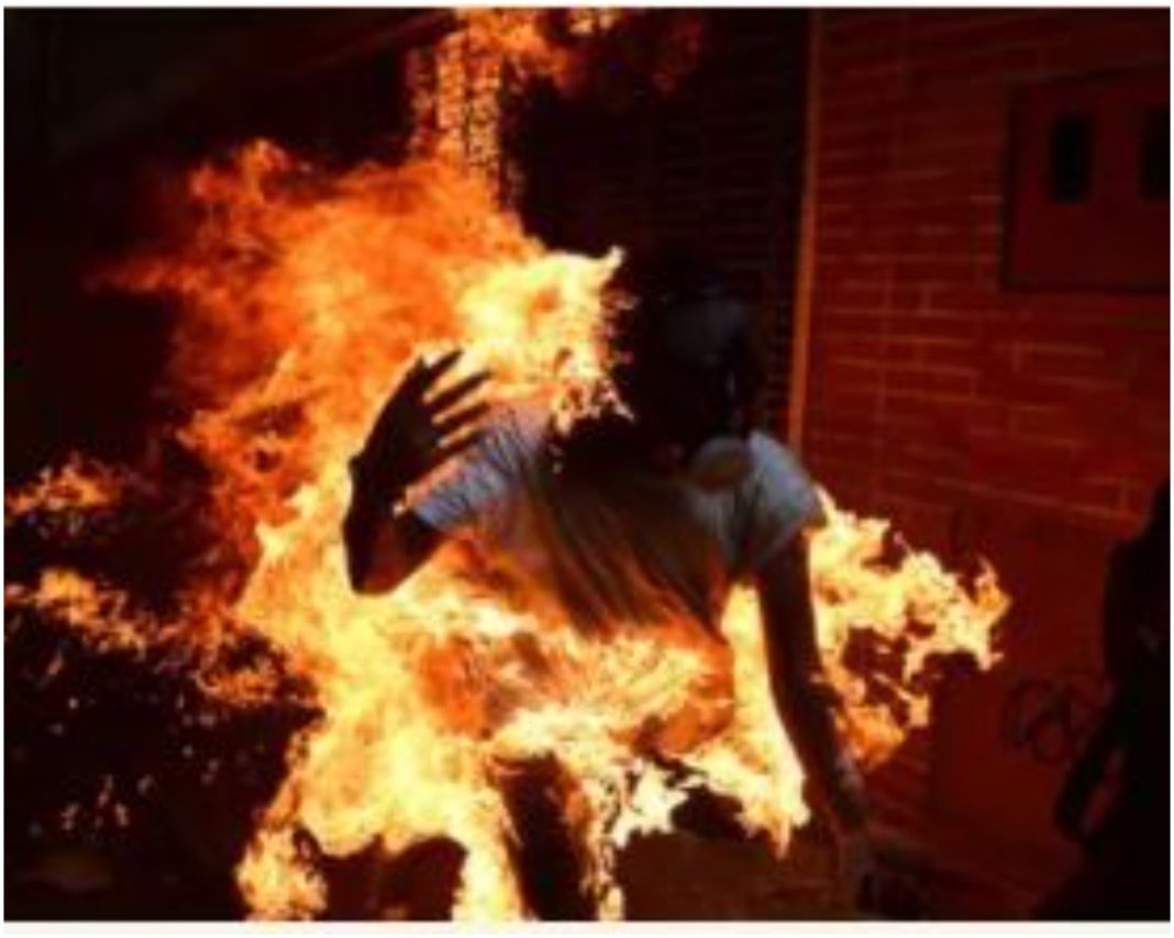 Man Burnt to Death in Lagos