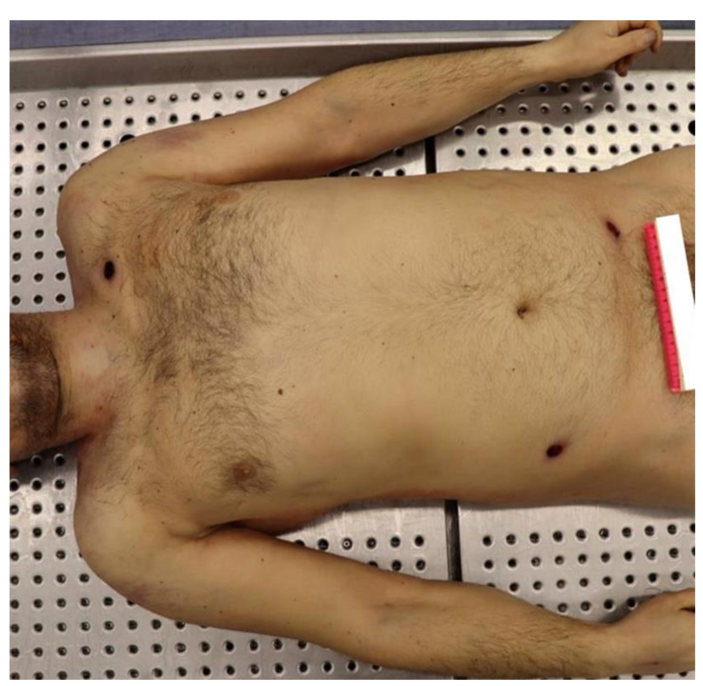 A’Ibom Morticians to reject corpses with bullet wounds without police report