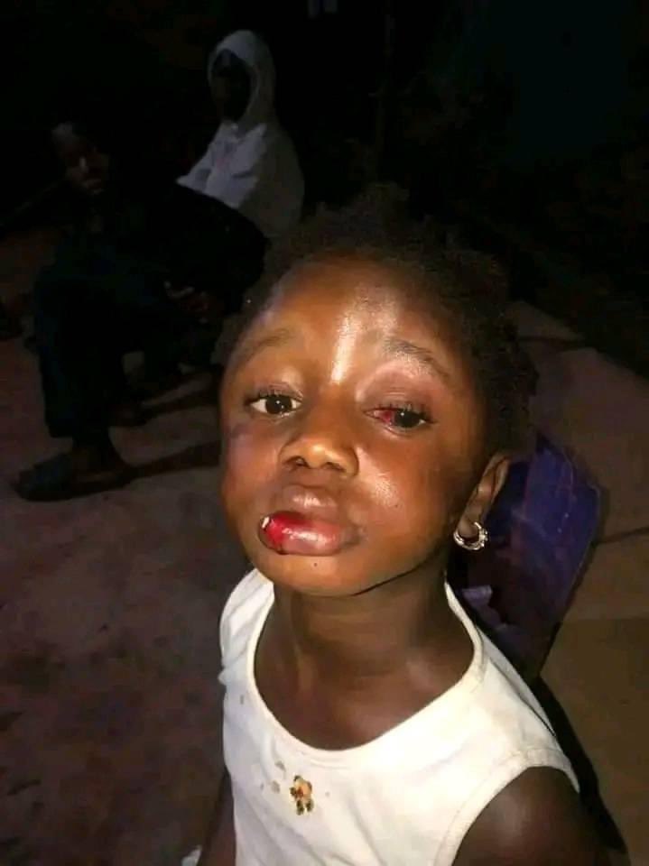 Woman Brutally Beats 5-Year-Old Girl for Taking Food
