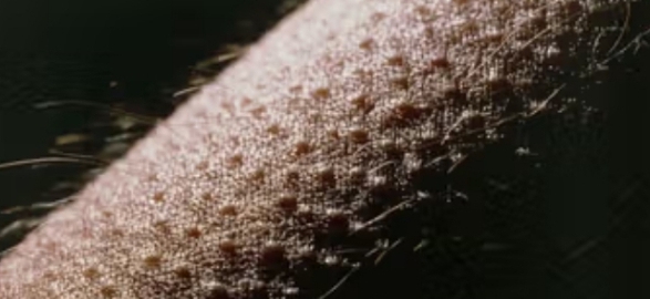 Goosebumps in Hot Weather: Why It Could Be Dangerous
