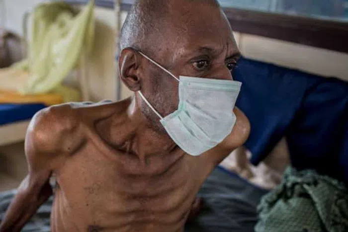 Six Diseases Now Deadlier Than HIV Globally — WHO Data